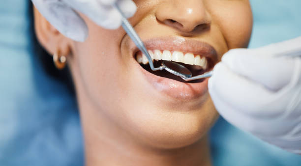 Best Emergency Tooth Extraction  in Sausalito, CA
