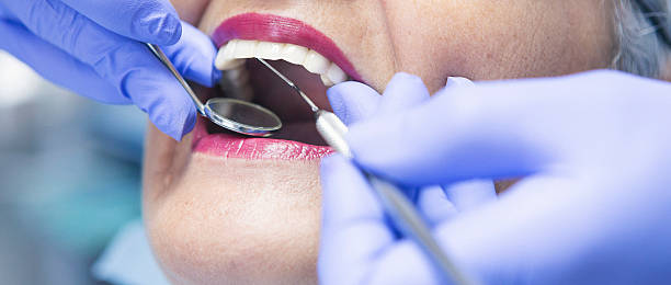 Best Chipped Tooth Repair Near Me  in Sausalito, CA